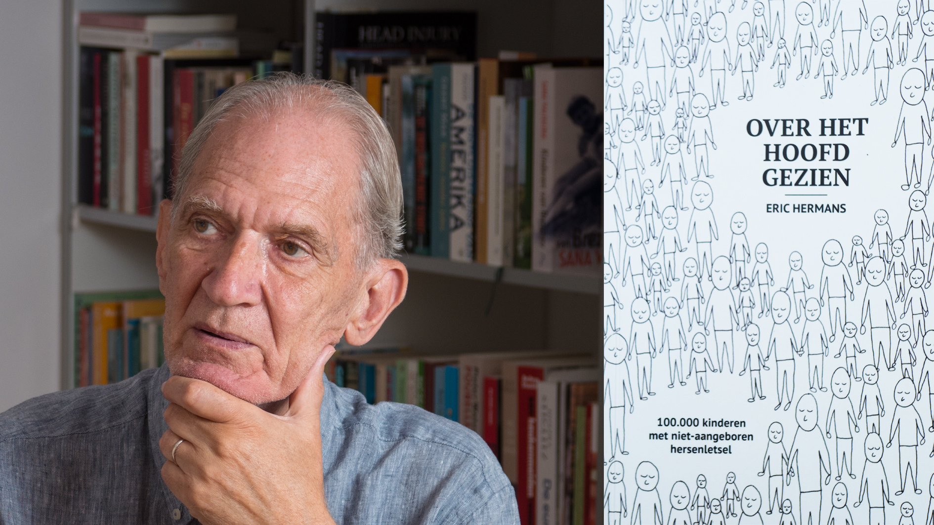 Over het hoofd gezien